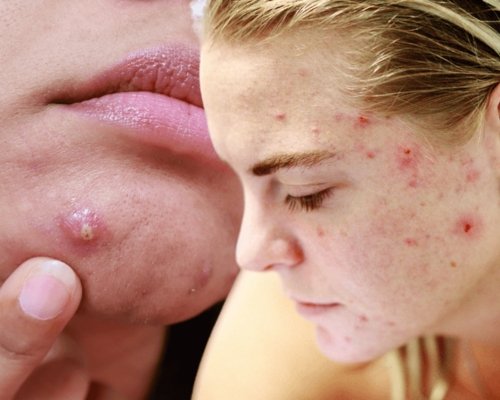 Skin Problems services in Roorkee